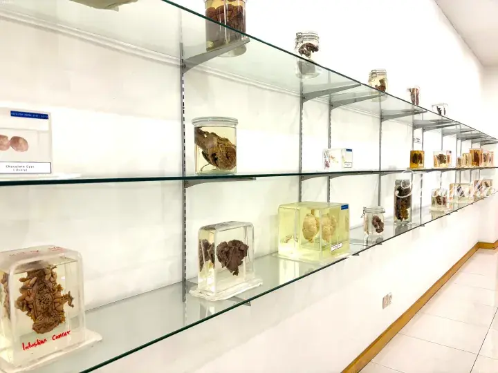 Glass display shelves in a pathology museum containing preserved organ specimens in jars and blocks.